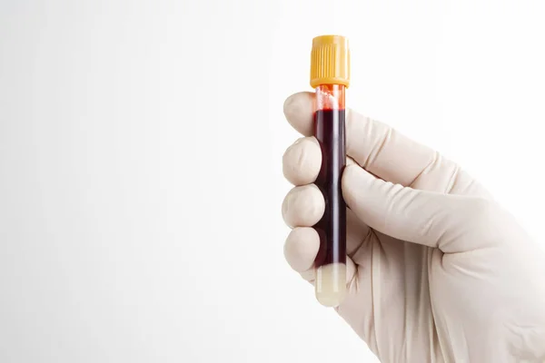 Male Nurse Presented Blood Test White Background — 스톡 사진