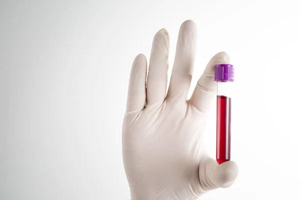 Doctors Hand Blood Sample Front Medical Laboratory — 스톡 사진