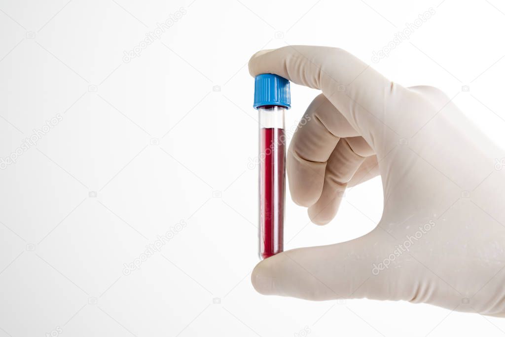 Doctor presenting tube with blood for complete blood test.