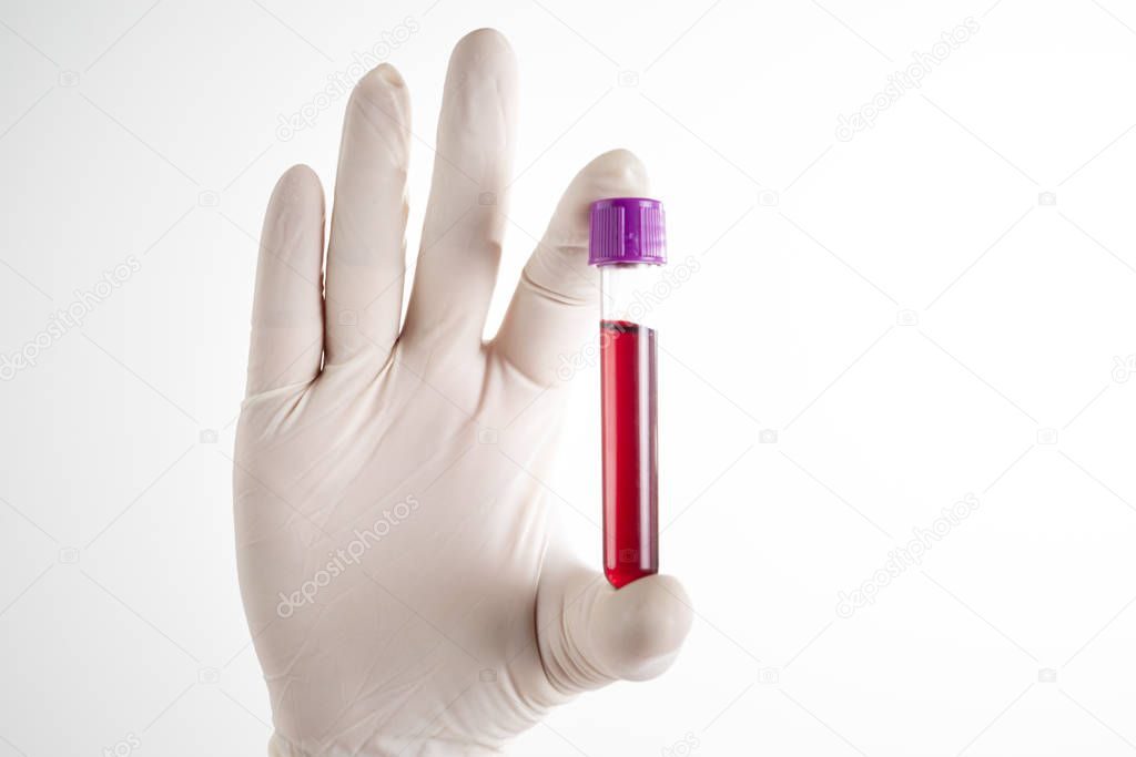 Doctor holding a bottle of blood sample.