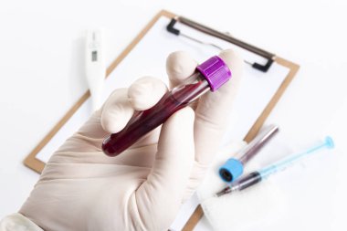 Doctor holding blood test over spreadsheet for analysis.