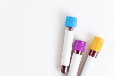 Vakum tüpündeki kan örneği beyaz arka planda izole edilmiş. Üst görünüm.