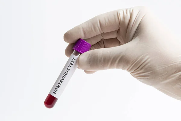 Hand Eines Arztes Mit Rotem Blut Reagenzglas Auf Weißem Hintergrund — Stockfoto