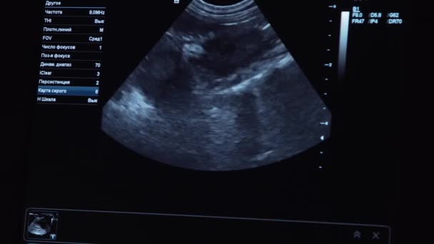 Diagnóstico por ultrassom em clínica veterinária. — Vídeo de Stock