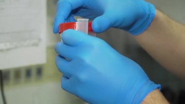 İdrar analizi Laboratuvarı.