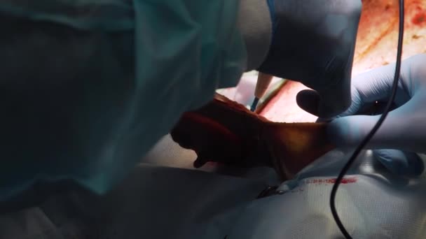 Chirurgische ingreep van een hond in een dierenkliniek — Stockvideo