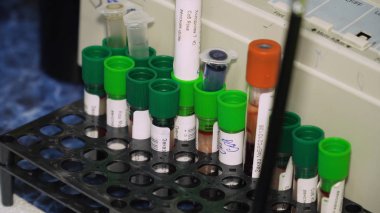 Tablo üzerinde kan olan test tüpleri.