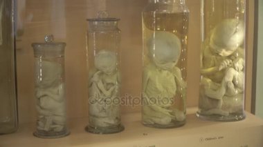 Formalin anatomik insan örnekleri