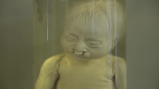 포 르 말린에 해부학 인간의 표본 — 비디오