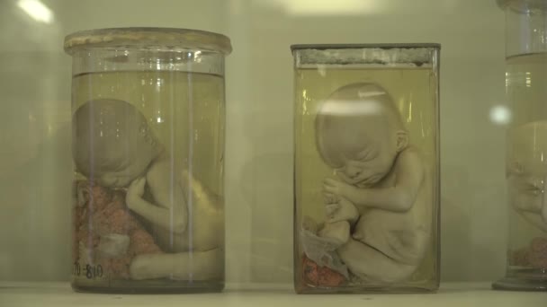 Anatomische menselijke specimens in formaline — Stockvideo