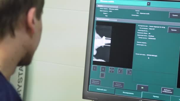 Arts kijken naar een röntgenfoto in een ziekenhuis — Stockvideo