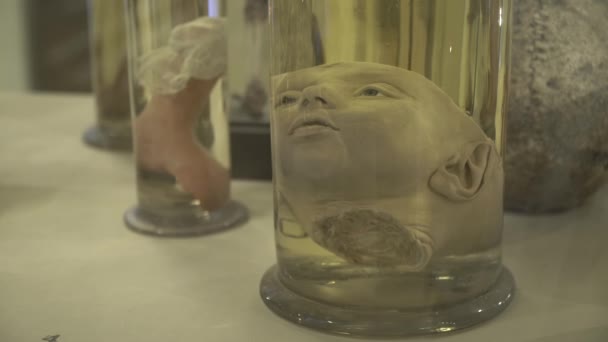 Анатомические образцы человека в формалине — стоковое видео