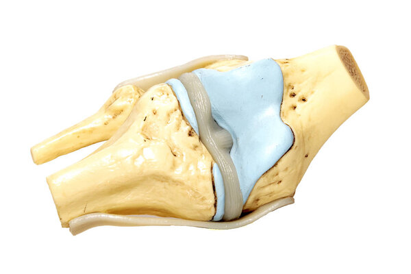 Модель коленного сустава на белом фоне
