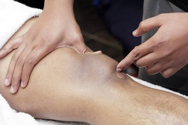 As mãos dos homens estão fazendo massagem esportiva por parte do corpo humano — Fotografia de Stock