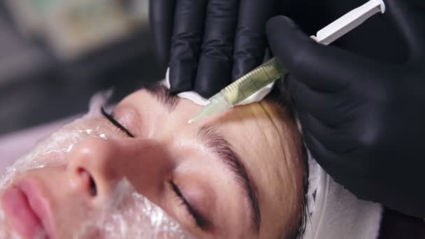 Doktor sprawia, że wiele wstrzyknięć w womans skóry twarzy podczas mezoterapii. Biorevitalization i face lifting, leczenie Niechirurgiczne medycyna estetyczna — Wideo stockowe