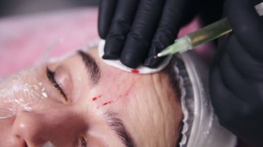 Doktorlar görünümünü portre siyah eldiven birden çok enjeksiyonları kadının yüz cilt içinde Mezoterapi sırasında yapma eller. Biorevitalization ve kaldırma, yüz tedavi ameliyatsız estetik tıp