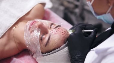 Portre profesyonel bir comsetologist siyah eldiven birden çok enjeksiyonları kadının içinde yapım görünümünü sırasında Mezoterapi cilt yüz. Biorevitalization ve kaldırma, yüz tedavi olmayan cerrahi tıp