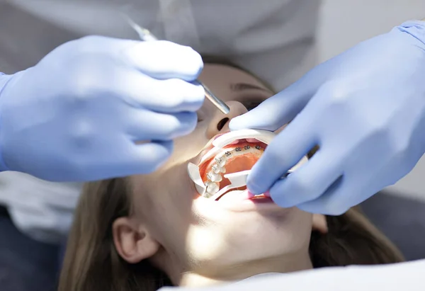 El dentista trata a una paciente con dientes en el consultorio del hospital —  Fotos de Stock