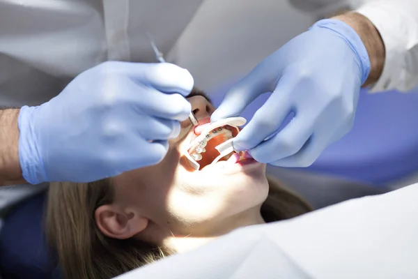 Extrémní záběr rukou pracujících na zubních rovnátkách se sekerou a ústním zrcadlem. Makro zblízka ženských úst ukazující zubní rovnátka. — Stock fotografie