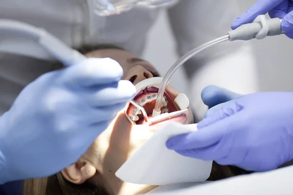 Médico dentista trata os dentes de uma bela jovem paciente. A rapariga na recepção do dentista. Médico dentista trata dente. — Fotografia de Stock