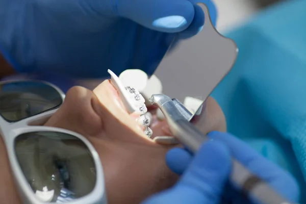 Ліки Від Зубів Молярне Лікування Молода Пацієнтка Відвідує Стоматологічний Кабінет — стокове фото