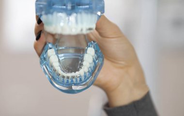 Diş ve ortodontik ofis ve laboratuvar sunum aracı. Diş Bakımı ve Ortodonti kavram insan çene modeli.