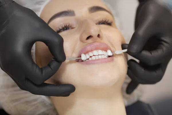 Krásná Evropská Žena Úsměv Zdravými Zuby Bělení Koncept Péče Zuby — Stock fotografie