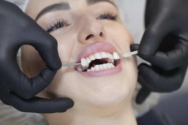 美丽的欧洲女人带着健康的牙齿面带微笑 牙科护理的概念 一组不同色调的植入物 — 图库照片