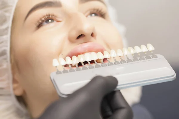 健康的な歯のホワイトニングで美しいヨーロッパの女性の笑顔 歯科医療の概念 さまざまな色調のインプラントのセット — ストック写真