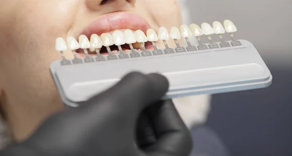 Hermosa Sonrisa Mujer Europea Con Dientes Sanos Blanqueamiento Concepto Cuidado —  Fotos de Stock