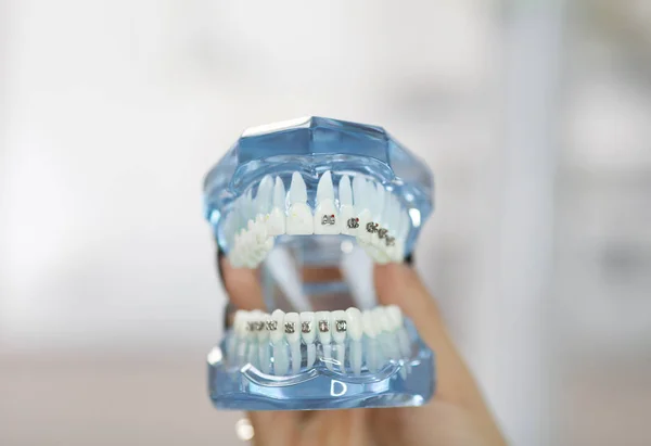 Dental and orthodontic office and lab presentation tool. Model of human jaw for dental care and orthodontics concept.