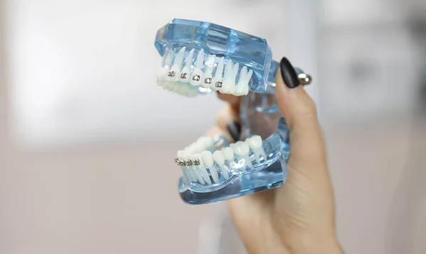 Dental and orthodontic office and lab presentation tool. Model of human jaw for dental care and orthodontics concept.