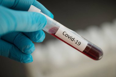 Tıbbi ekipman. Kan testi. Covid-19. Corona virüsü.
