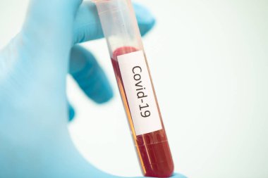 Covid-19 testi için kan örneği içeren test tüpü, Wuhan, Çin 'de bulunan yeni Coronavirus 2019..