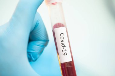 Covid-19 testi için kan örneği içeren test tüpü, Wuhan, Çin 'de bulunan yeni Coronavirus 2019..
