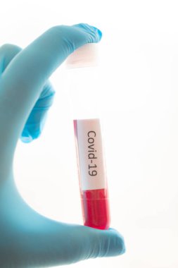 Covid-19 testi için kan örneği içeren test tüpü, Wuhan, Çin 'de bulunan yeni Coronavirus 2019..