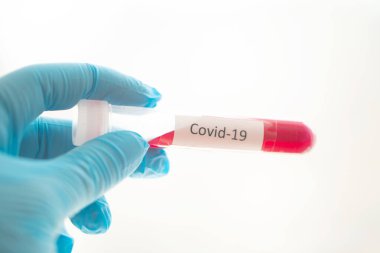 Covid-19 testi için kan örneği içeren test tüpü, Wuhan, Çin 'de bulunan yeni Coronavirus 2019..