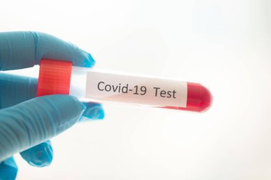 Covid-19 testi için kan örneği içeren test tüpü, Wuhan, Çin 'de bulunan yeni Coronavirus 2019..