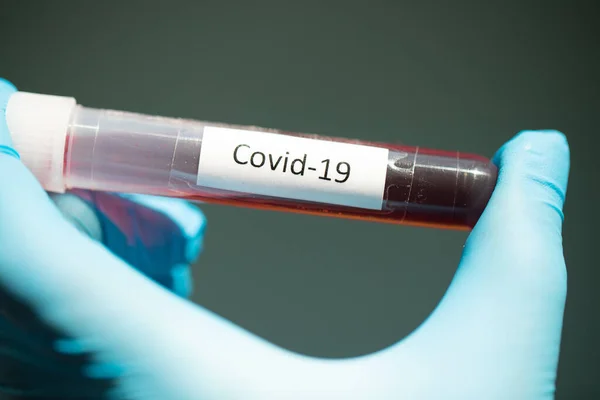 Matériel Médical Test Sanguin Covid Virus Couronne — Photo