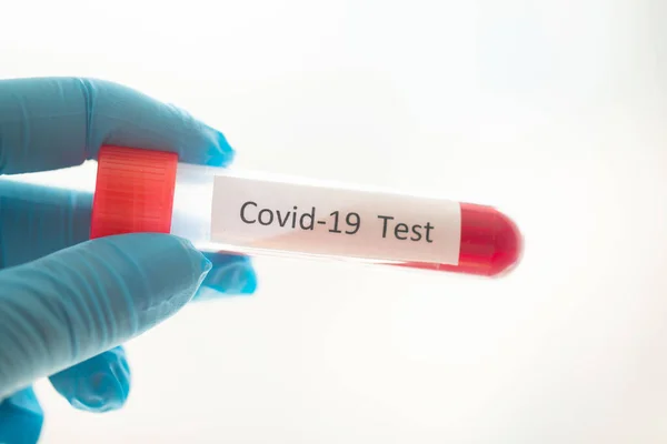 Tube Essai Avec Échantillon Sang Pour Test Covid Nouveau Coronavirus — Photo