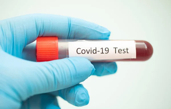 Matériel Médical Test Sanguin Covid Virus Couronne — Photo