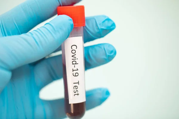 Provetta Con Campione Sangue Test Covid Nuovo Coronavirus 2019 Trovato — Foto Stock