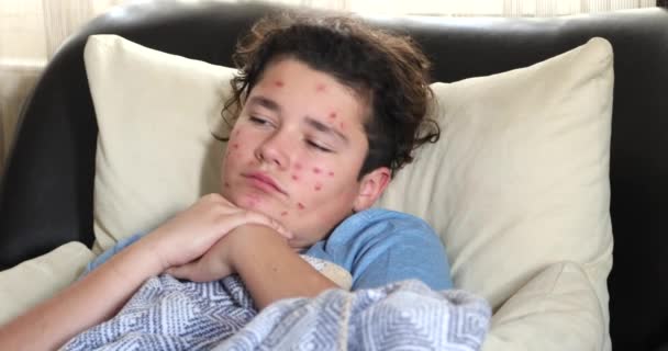 一个疲惫的小男孩的画像 他患有水痘疹 抓挠自己的脸 躺在沙发上看电视 — 图库视频影像