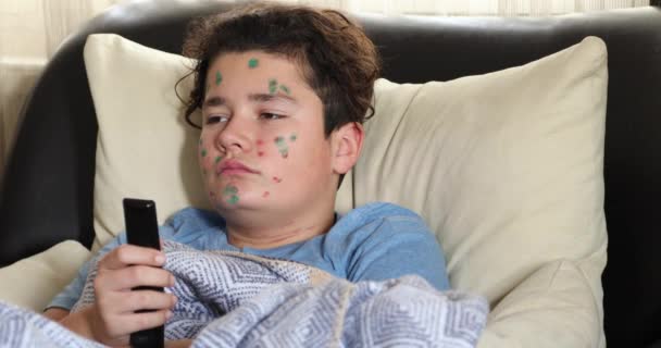 水痘を患っている疲れた少年の肖像彼の顔を引っかき ソファに横たわってテレビを見て — ストック動画