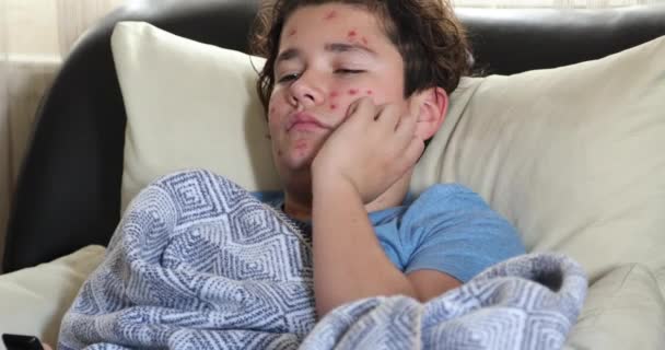 Portrait Tired Young Boy Suffering Chicken Pox Rash Scratching His — Stock Video