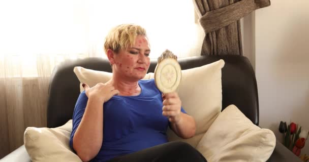 对中年妇女面部和颈部进行皮疹治疗 — 图库视频影像