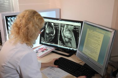 Vinnitsa, Ukrayna, 13 Temmuz 2017: Tıbbi test tarama / modern bir hastanede muayene.