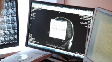 Bilgisayarlı tomografi laboratuvarı. 