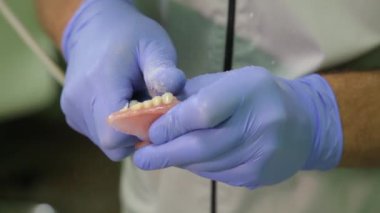 Diş Protez, takma diş, protez çalışma. 