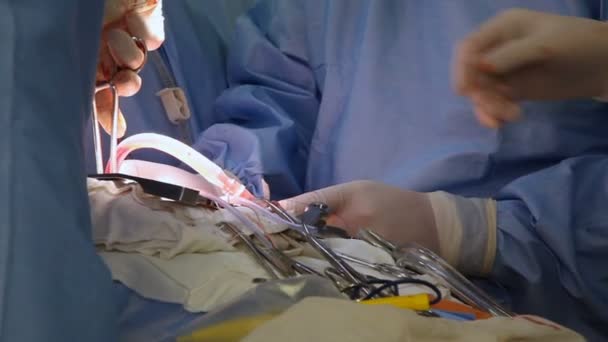 Cerrahlar Operasyon Ekibi Kalp Ameliyatı Ameliyatta Çalışır — Stok video